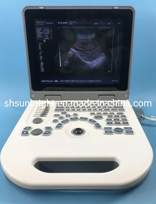 Ob/Gyn Medical Ultrasound Two Probe Connectors Ultrasound Best Cardiology Ultrasound