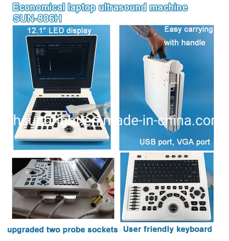 China Ultrasound Sun-806h Portable Laptop Ultrasound Machine Ultrasound in United States
