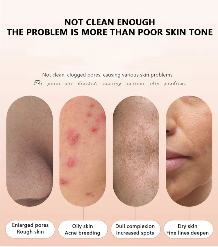 Vacuum Suction Blackhead Removal Device Facial Pore Cleanser Fine Lines Reduction