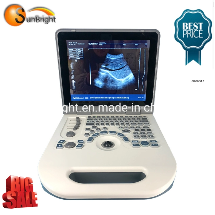 Ultrasound B Ultrasound Human Convex Probe Laptop Ultrasound Scanner