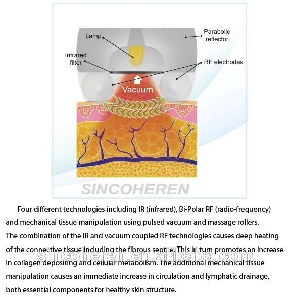 High Quality Cellulite Removal Slimming Machine Velashape