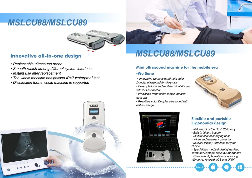 Color Doppler WiFi Wireless Ultrasound Linear Ultrasound Scanner Wireless Ultrasound