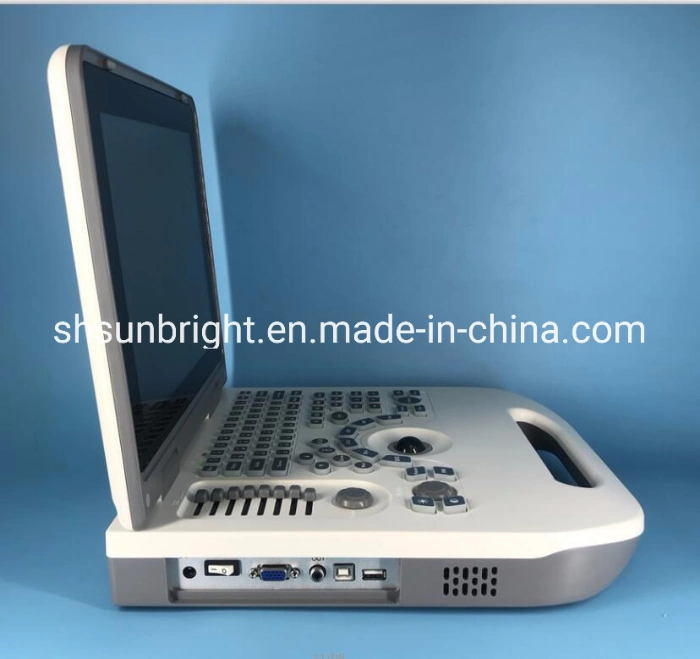 Msk Ultrasound Price Pregnancy Baby Ultrasound Machine Device Ultrasound USG