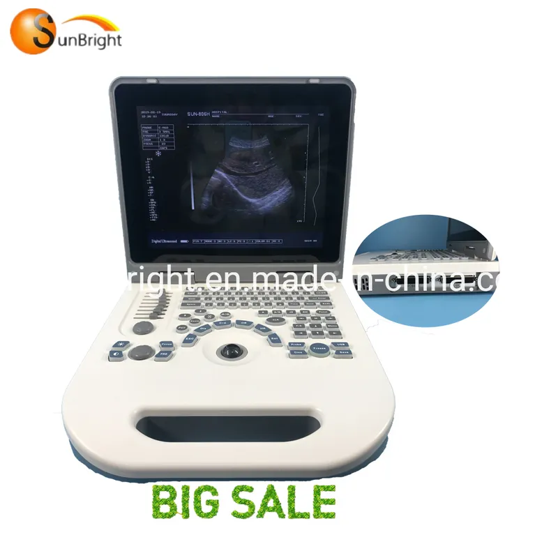 Ob/Gyn Medical Ultrasound Two Probe Connectors Ultrasound Best Cardiology Ultrasound