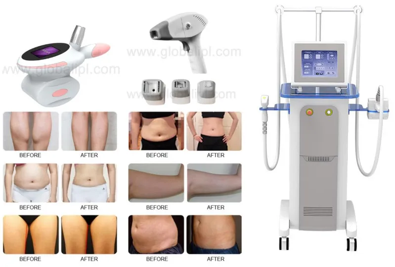 RF Wrinkle Removal Roller Vacuum Body Slimming Apparatus
