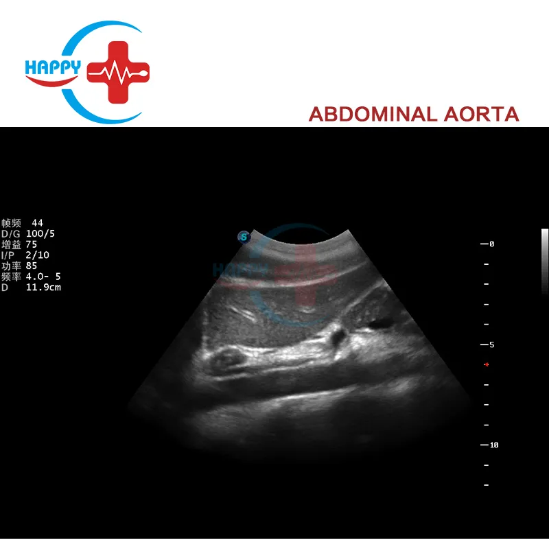 Clinic Use Sonoscape Ultrasound Price /Ultrasound Machine P9 /Sonoscape Ultrasound