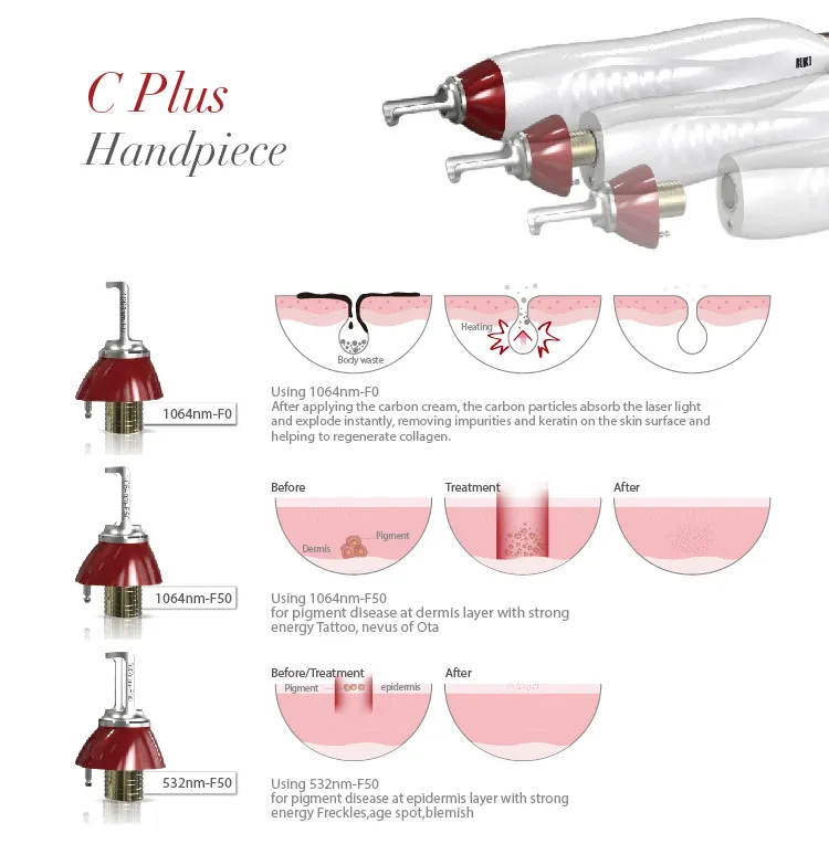 Laser ND YAG Q-Switched Picosecond Laser Tattoo Removal Machine