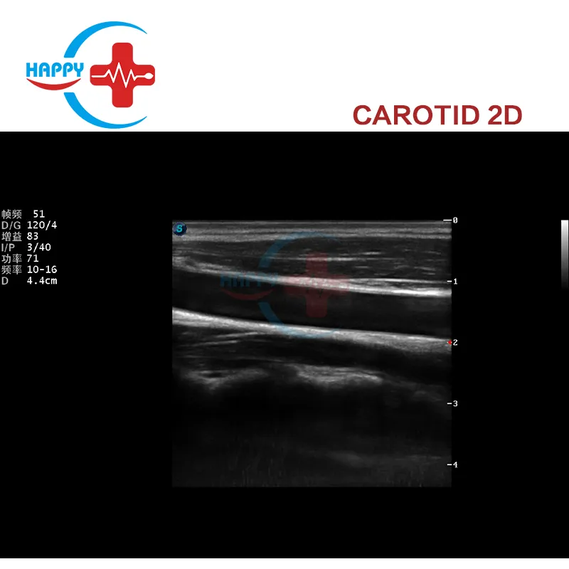 Clinic Use Sonoscape Ultrasound Price /Ultrasound Machine P9 /Sonoscape Ultrasound