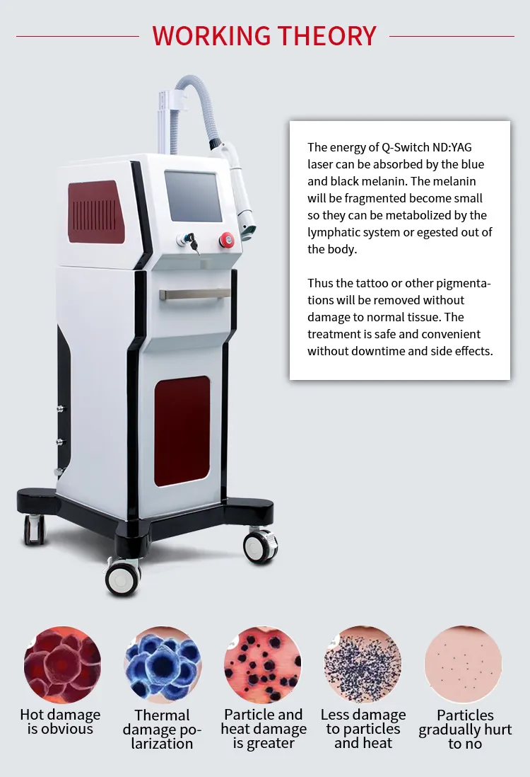 Q-Switch ND YAG Laser Birthmark Removal Tattoo Removal Equipment