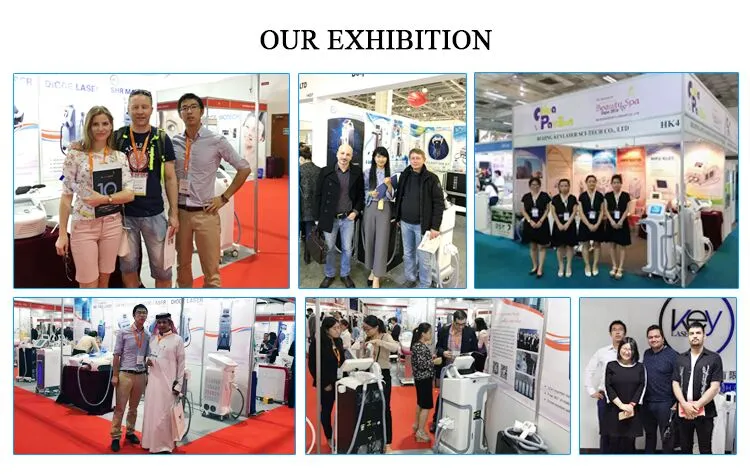 E Q Switch ND YAG 532nm 1064nm 1320nm Laser Tattoo Removal