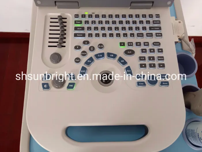 Msk Ultrasound Price Pregnancy Baby Ultrasound Machine Device Ultrasound USG