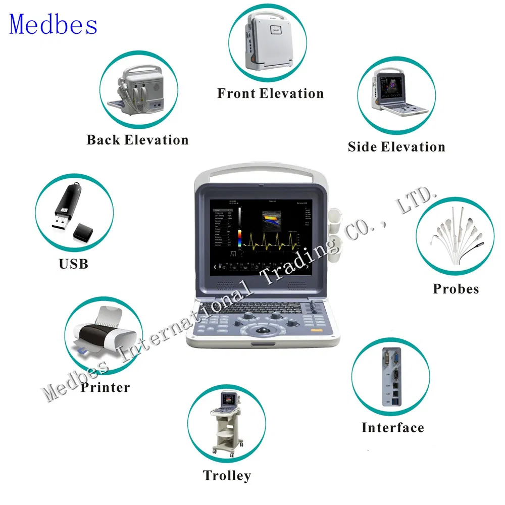 Ultrasound Machine Portable/Ultrasound Machine Color Doppler Ultrasound