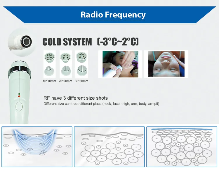 RF Face Lifting Q-Switched Laser & Opt Shr Hair Removal Machine