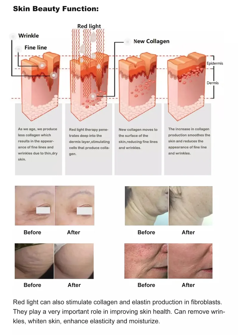Photomodulation Body Fat Burning Infrared Red LED Light Therapy Panels