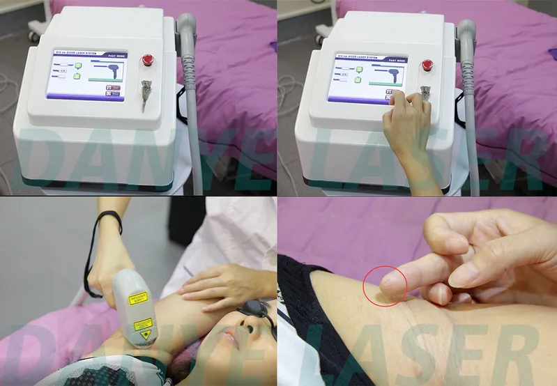 Diode 808nm Laser Hair Removal Danye Laser