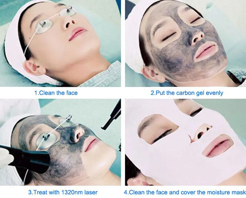 ND YAG Carbon Facial Laser Tattoo Removal Skin Beauty Equipment