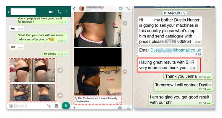 Globalipl Cryolipolysis Fat Freezing Machine