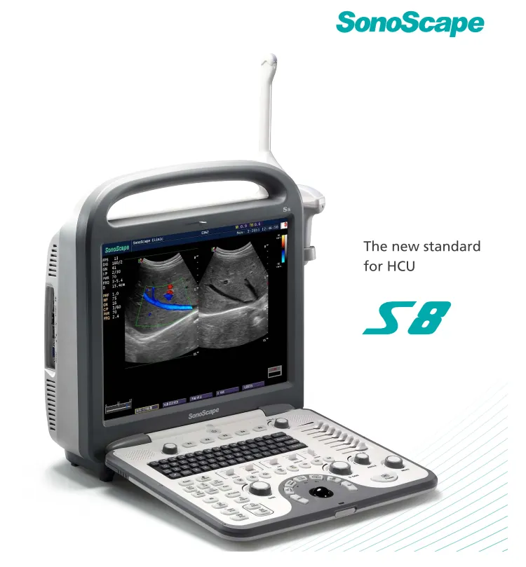 Sonoscape S8 Portable 4D Color Doppler Ultrasound Portable Laptop Ultrasound Machine Sonoscape Ultrasound Price