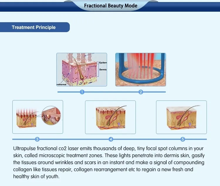 Skin Laser CO2 Skin Excision Vaginal Tightening