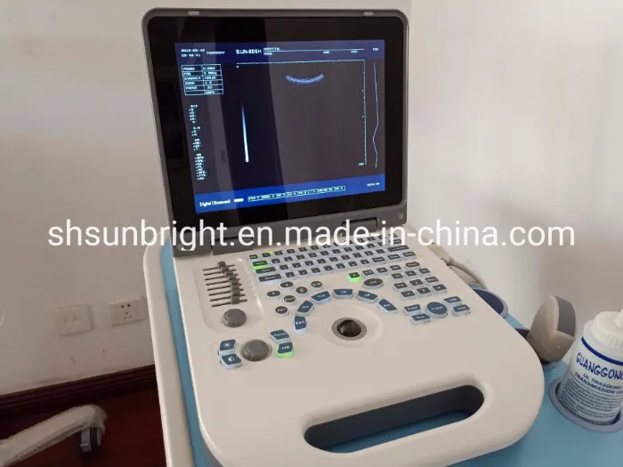 Msk Ultrasound Price Pregnancy Baby Ultrasound Machine Device Ultrasound USG