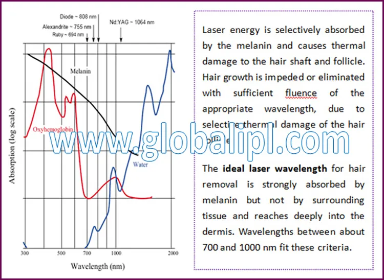 Best Machine for Laser Hair Removal