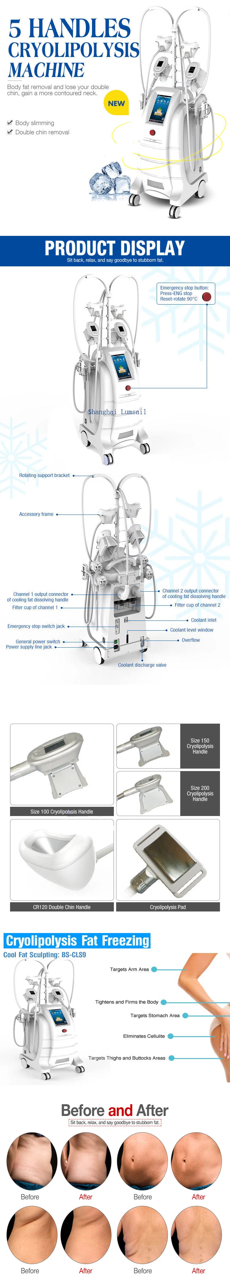 5 Handle Double Chin Treatment and Weight Loss Cryolipolysis Fat Freezing Machine