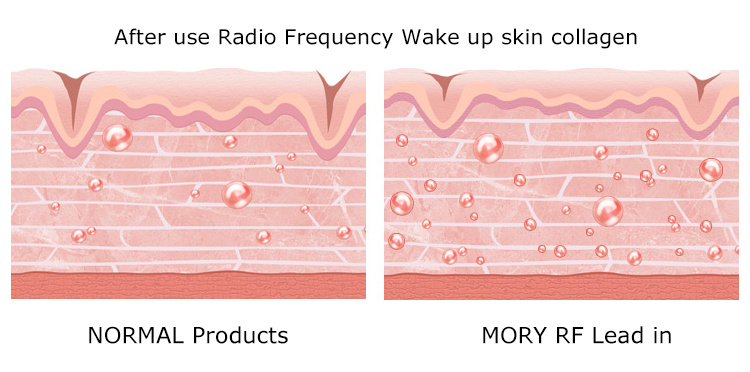 Mory Micro Current Face Lifting Machine Skin LED Light Therapy Face Lifting Microcurrent Face Lift Machine