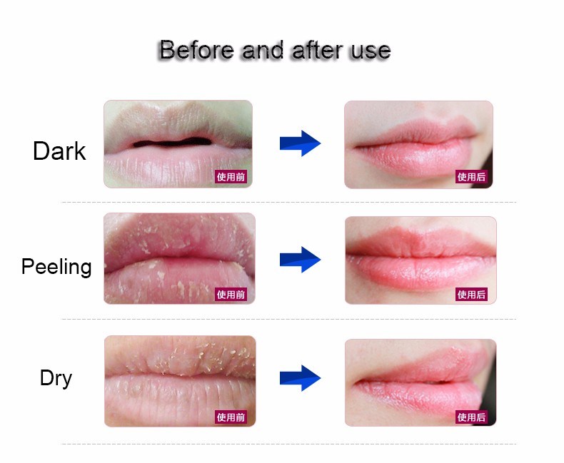 Nourishing Moisturizing Transparent Hydrogel Crystal Collagen Lip Mask