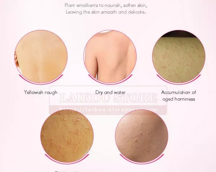 Laikou Gentle to Skin Nourishing Moisturizing Anti-Wrinkle Moisturizing Body Lotion Body Cream Skin Care