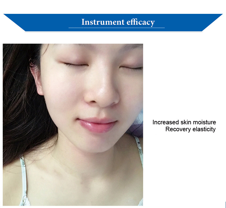 See You Water Oxygen Wrinkle Removal Device Facial Massage Machine