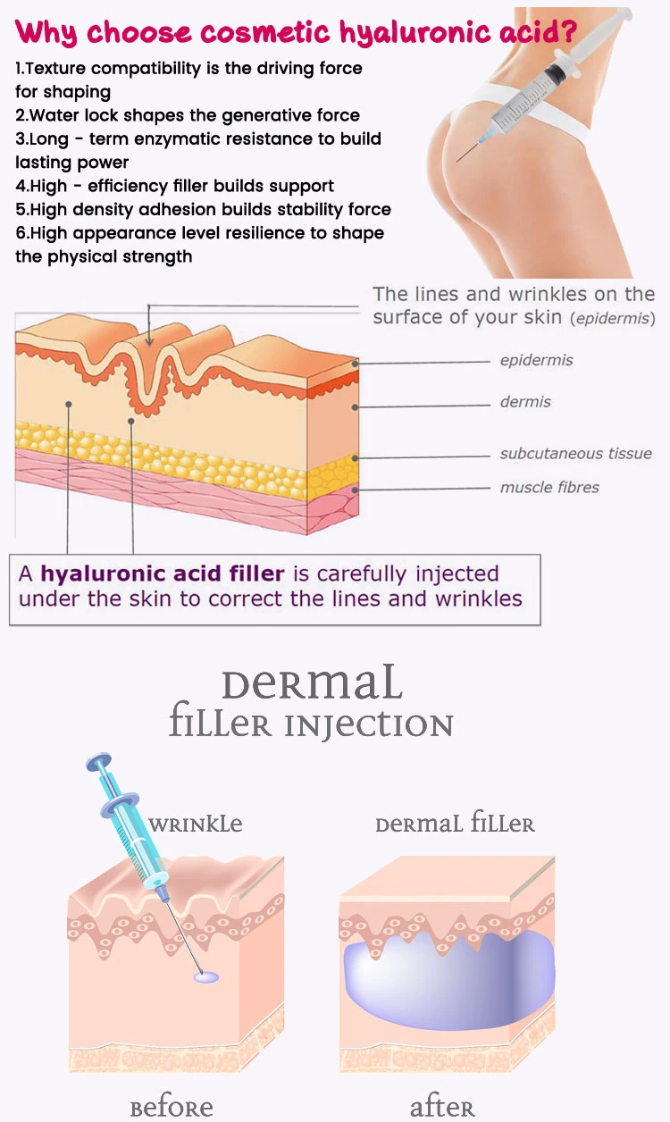 Collagen Long Duration Breast Filler Injectionand Enlarging Breast Hyaluronic Acid Filler